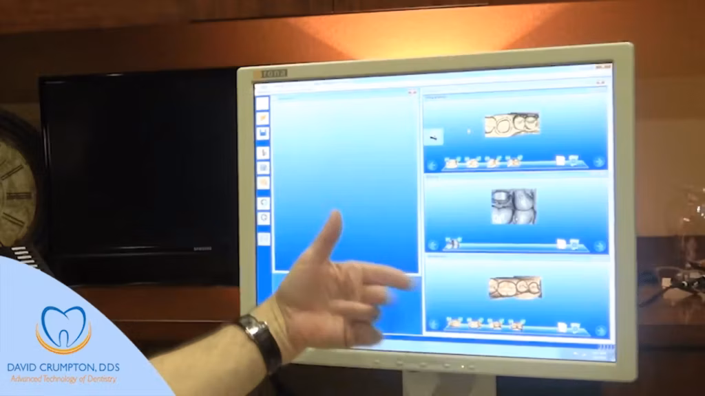 CEREC same-day dental crown technology at Complete Dentistry Trophy Club